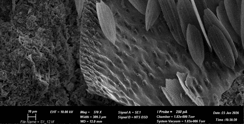 scanning-electron-micrograph